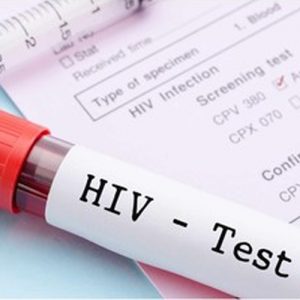 نشانه های اولیه ابتلا به بیماری ایدز HIV